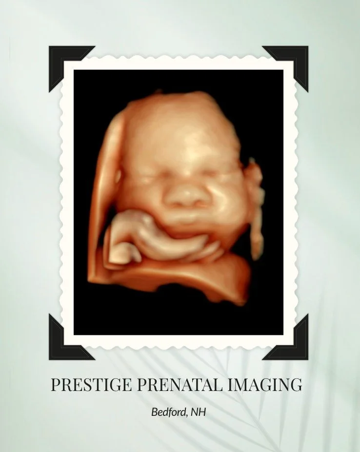 ✨ One of those wow moments 
This 3D image is as perfect as it gets &mdash; so clear, so detailed, and you can truly see every little feature. 😍

Images like this aren&rsquo;t always easy to capture, but our registered sonographers are experts at wha