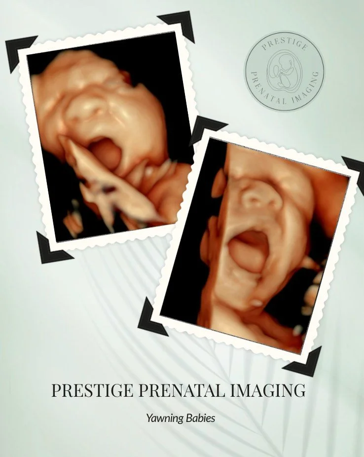 💛 Caught mid-yawn&hellip; twice!
These two sweet babies gave us the cutest glimpse as they practiced their yawns, stretches, and tiny facial movements during their 4D session. 

From yawning and smiling to all those little expressions, every session