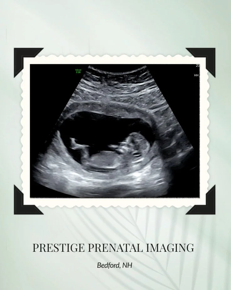 ✨ Sneak Peek magic ✨
We absolutely love early ultrasounds like this one! There&rsquo;s something so special about seeing baby early on &mdash; watching that tiny heartbeat flicker and getting to explain all the anatomy as this little one grows and mo