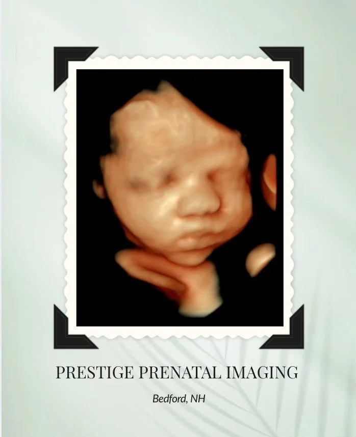 🥰 Just look at that precious little face!
We can&rsquo;t get enough of babies who are ready for their close-up &mdash; this little one was absolutely photo-ready! 📸👶

Those tiny features, that perfect pose&hellip; moments like this are exactly why