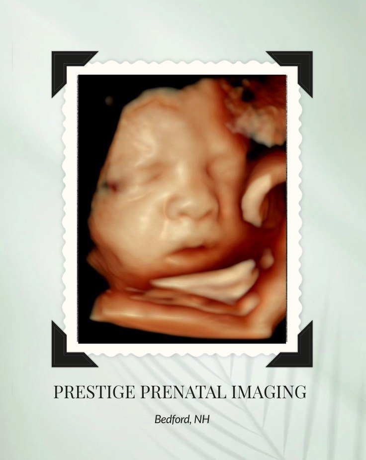 ✨ Someone was ready for their photoshoot! ✨
This sweet baby gave us the cutest little pose &mdash; and we are obsessed with this adorable face! 😍👶

We love when babies cooperate and let us capture these beautiful moments for their families. Seeing 