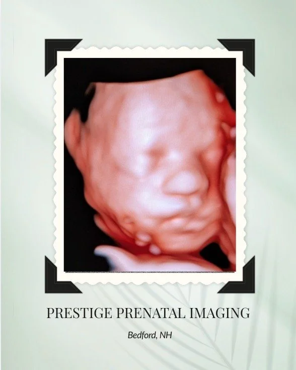 We just love a baby who&rsquo;s ready for their close-up!
Check out this sweet little face &mdash; this baby clearly didn&rsquo;t mind the camera one bit. Moments like this make 3D/4D ultrasounds so special. Being able to see your baby&rsquo;s tiny f