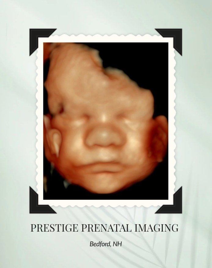 🌸 Hello Spring&hellip; and hello sweet baby! 🌸

On this first day of spring, we captured this beautiful 3D image of the sweetest little face. What a perfect way to welcome a new season &mdash; with new life and growing families! 🌷

We love being a