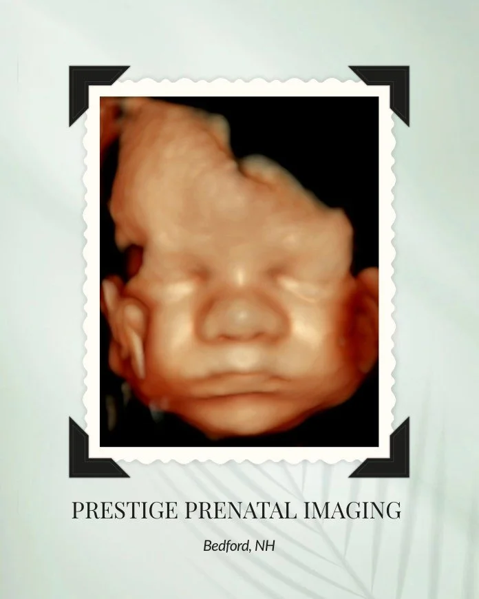 Can we just take a moment for this perfect little face?! 💕

We are obsessed with this image &mdash; capturing these sweet features so clearly is what makes 3D/4D ultrasounds so special. Moments like this never get old! ✨

If you&rsquo;re looking for