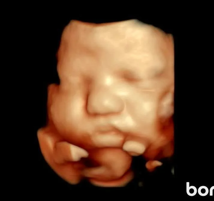 Absolutely precious 💕 Look at that sweet little face already! These beautiful 3D/4D images of this baby girl are something her family will treasure forever&mdash;tiny features, peaceful moments, and a glimpse of the love that&rsquo;s already here ✨
