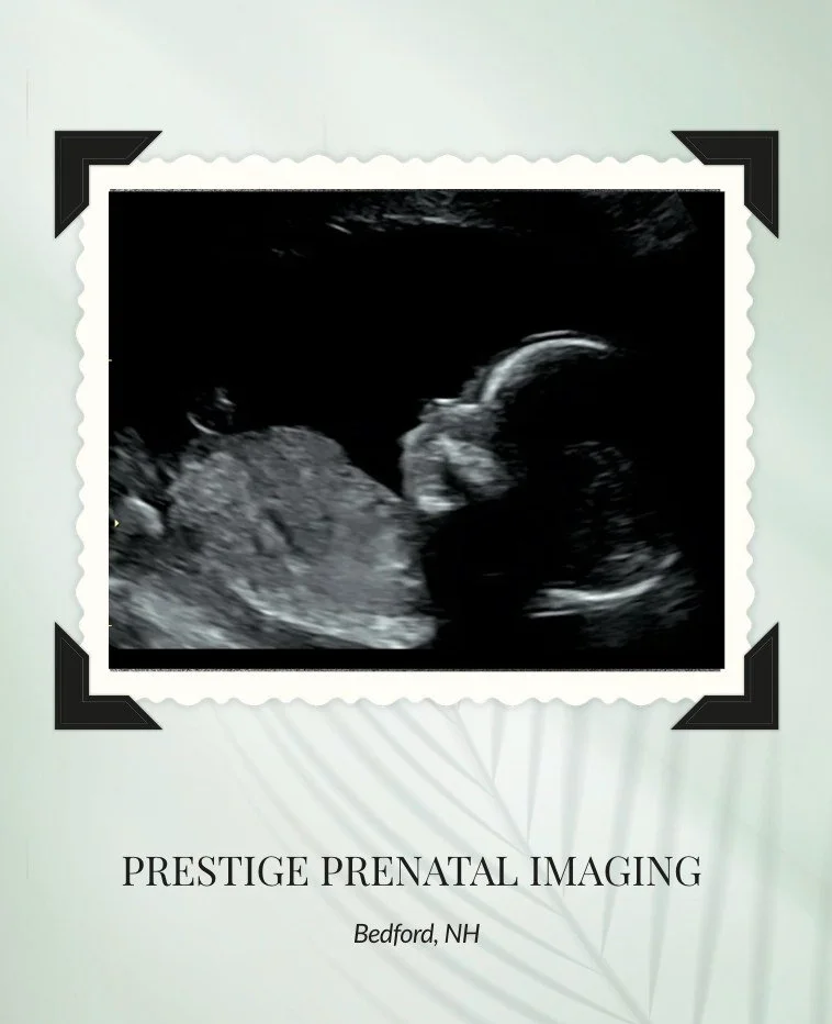 Check out this sweetest little profile!!

How perfect is this beautiful lateral image of this sweet baby?! This is a great example of a 2D ultrasound, which means classic black &amp; white imaging. 🖤

At Prestige Prenatal Imaging, we start offering 