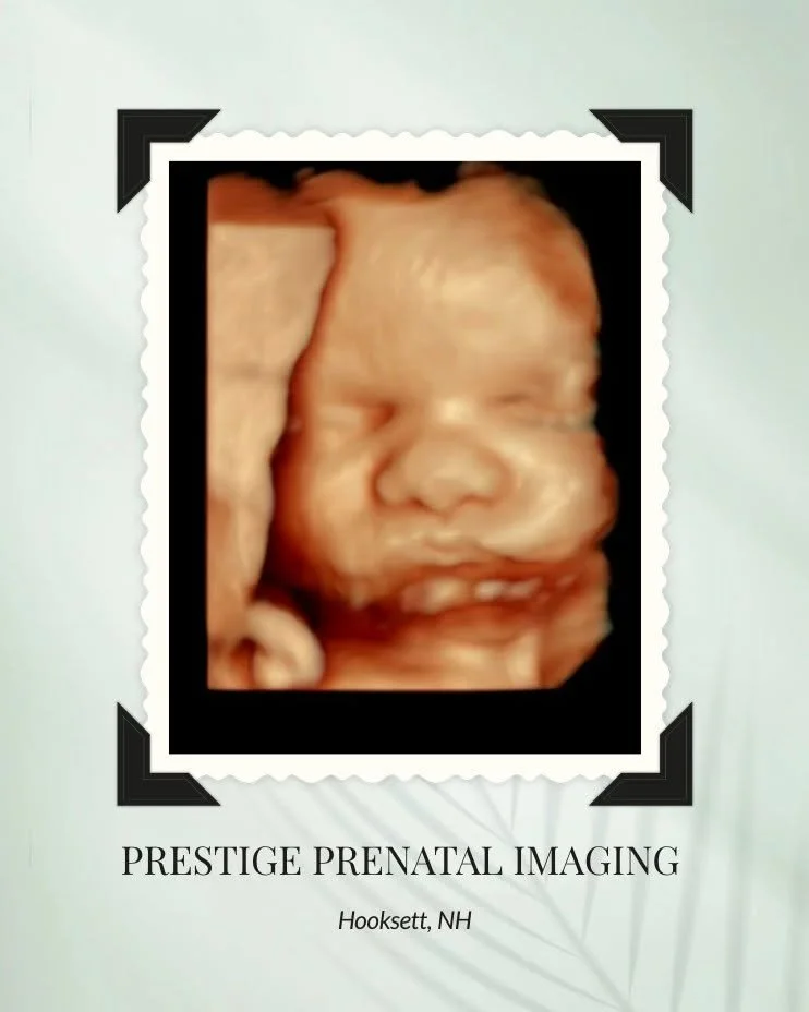 The babies SHOWED UP this weekend ✨

We captured so many beautiful 3D ultrasound images and shared some truly unforgettable moments with amazing families this weekend. And seriously&hellip; look how cute this little guy is already! 💙

There&rsquo;s 