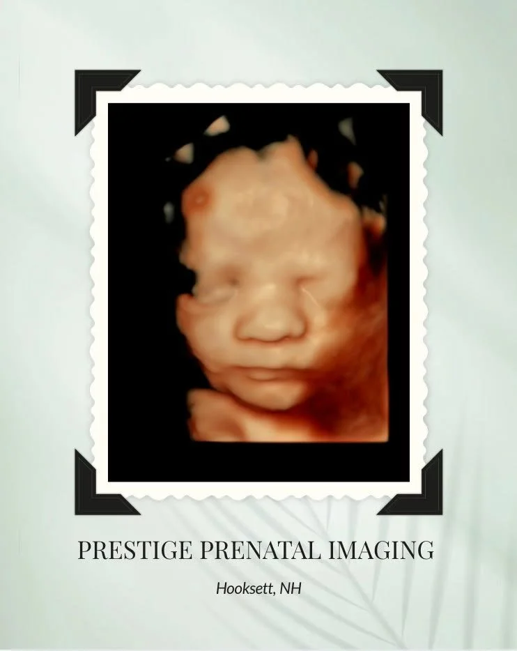 Absolutely sweet, precious, and already so loved 🤍

We never get tired of seeing families experience that magical moment of seeing their baby&rsquo;s little face for the very first time in 3D. From tiny cheeks to sweet little expressions, these mome