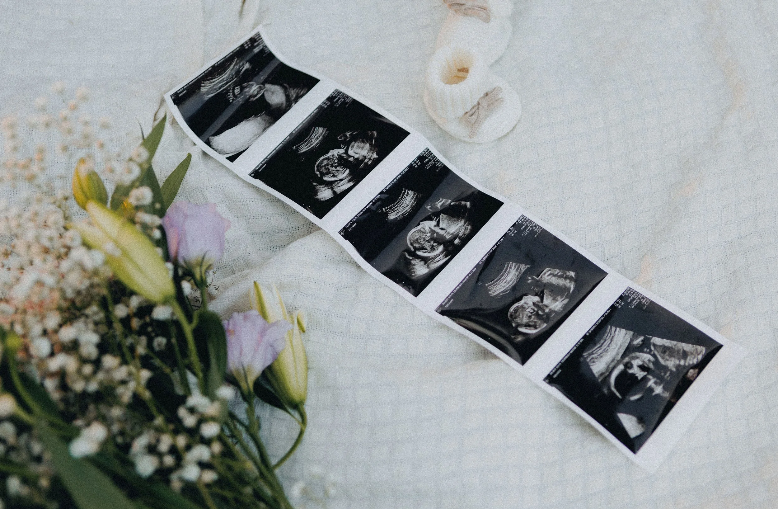 Maternity shoot with ultrasound