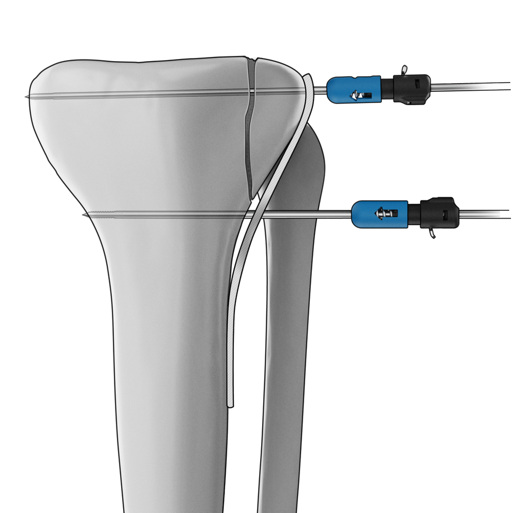 Home Page [axiaortho.com]