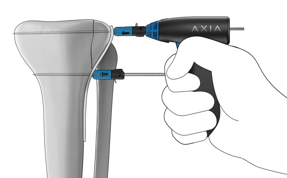 Home Page [axiaortho.com]