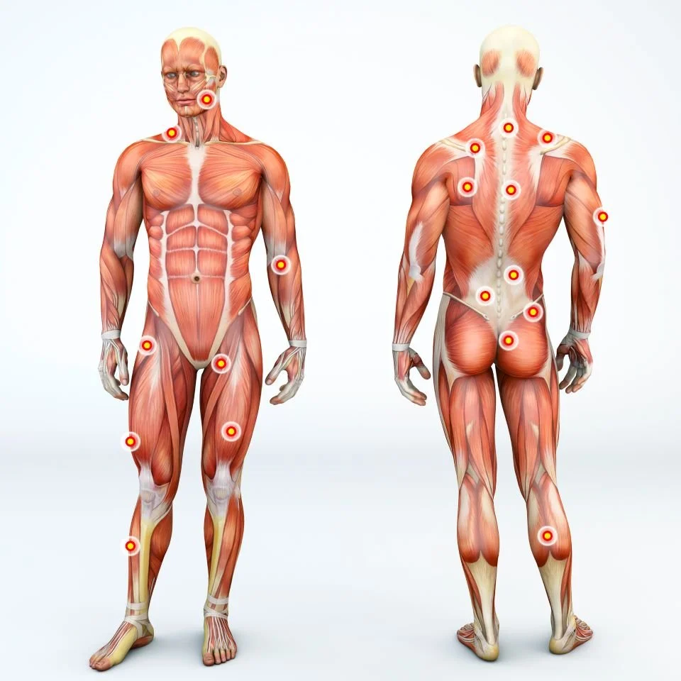Muscle Strain Treatment — Ducker Physio Adelaide