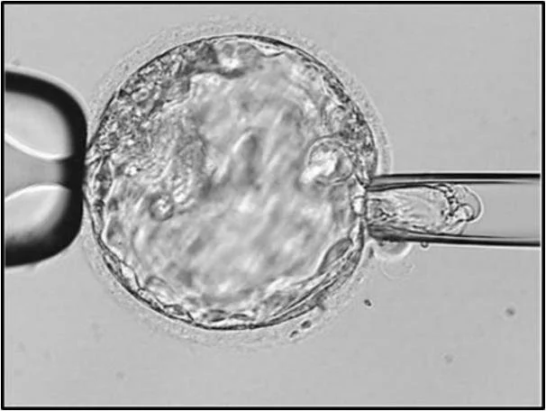 PGT-A Testing