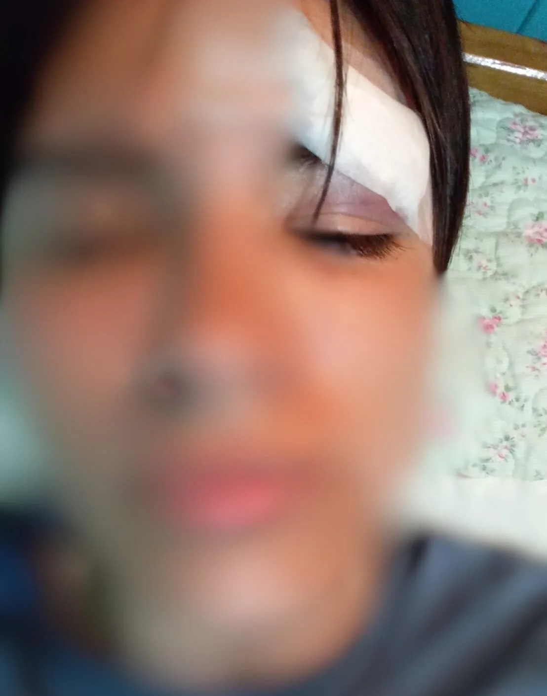 Denuncian brutal agresión a estudiante del Liceo Bicentenario Polivalente de San Nicolás y ocultamiento de pruebas