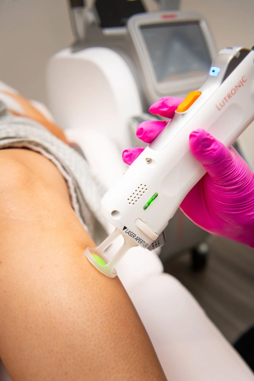 Client getting laser hair removal in Tomball, Texas