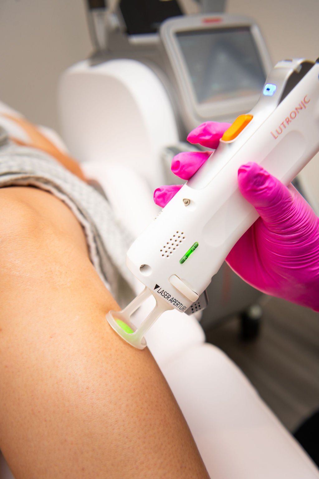 Certified Laser Hair Removal Specialist treating woman's leg with dual-wavelength laser in Tomball, TX by a Tourmaline Laser Specialist - Medical Aesthetician.
