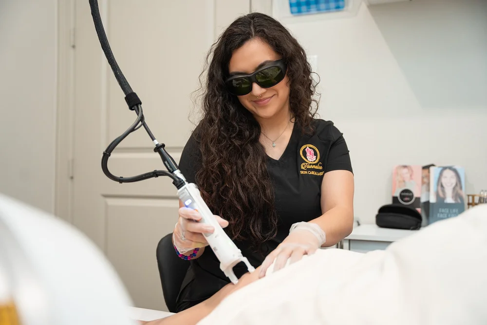 Laser hair removal with the Clarity II at Tourmaline
