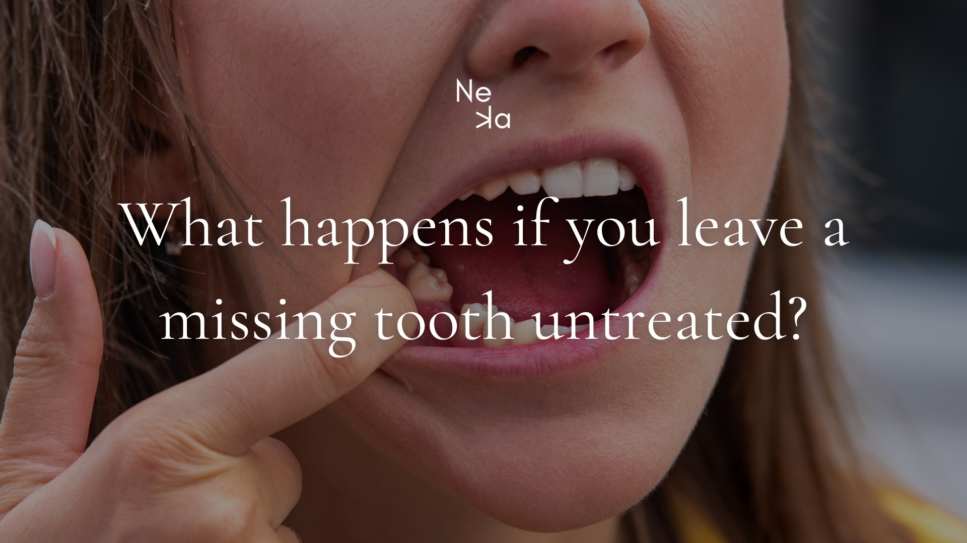 What happens if you leave a missing tooth untreated?