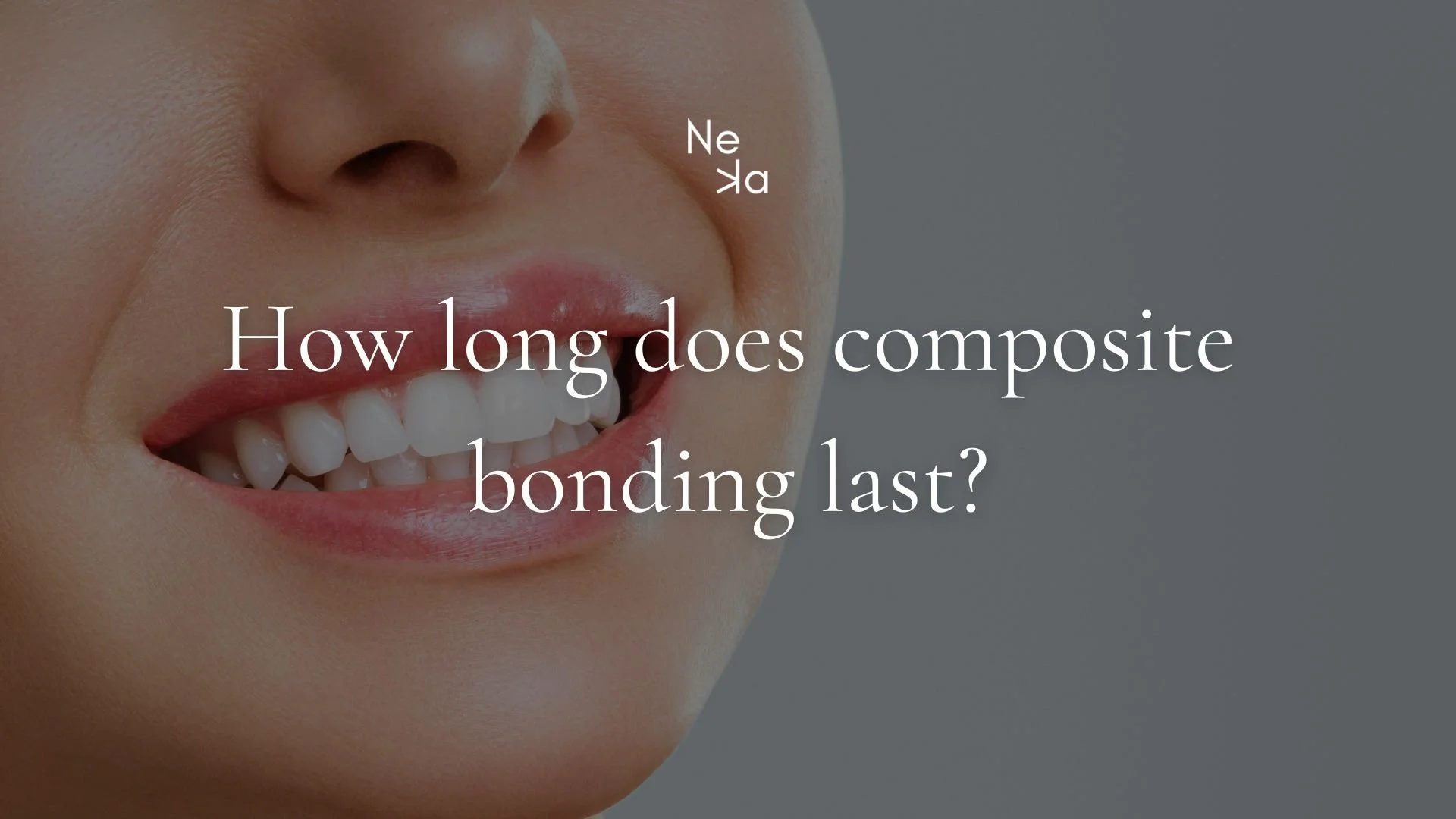 How long does composite bonding last?