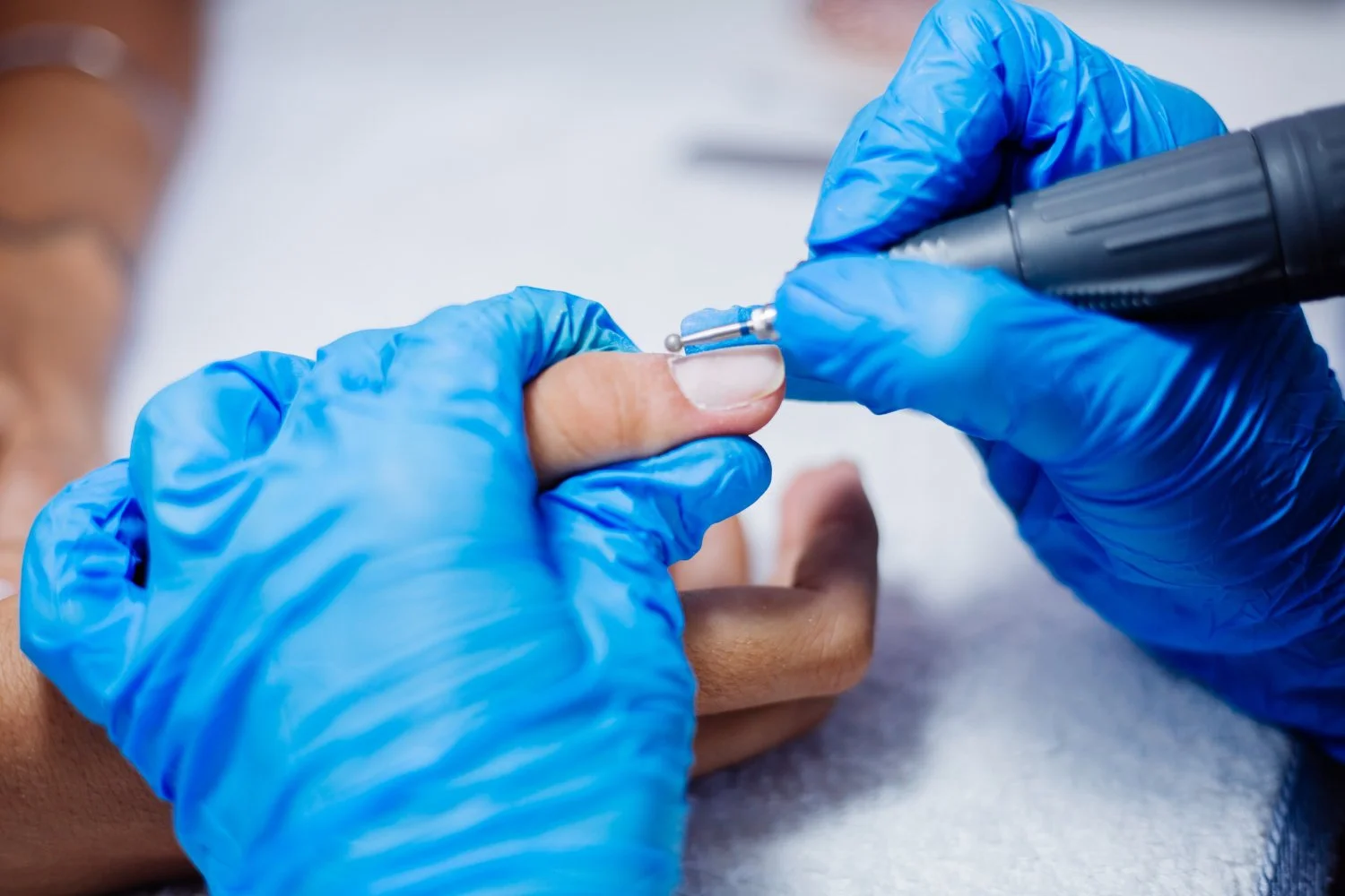 Professional Ingrown Toenail Treatment: Expert Mobile Foot Care & In‑Home Podiatry