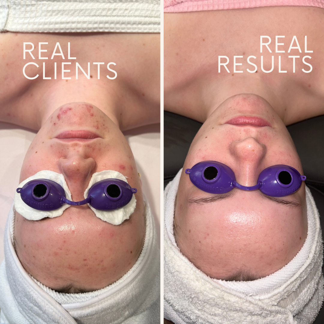 Minimalist Modern Before After Beauty Instagram Post.png