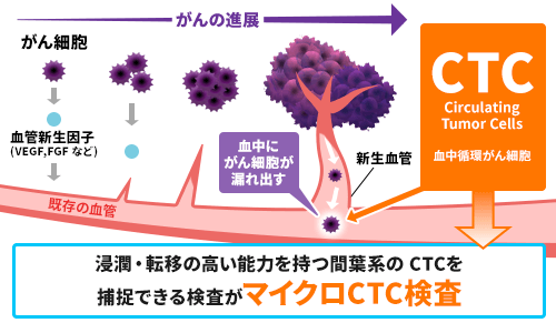 血液中を循環し始めた間葉系がん細胞の図。