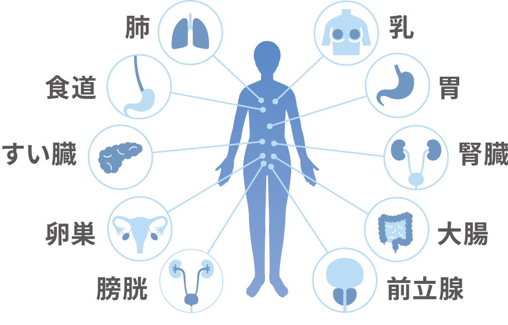 マイシグナルでがんリスクを調べられる臓器の図。肺、乳、胃、腎臓、大腸、前立腺、膀胱、卵巣、すい臓、食道、卵巣。