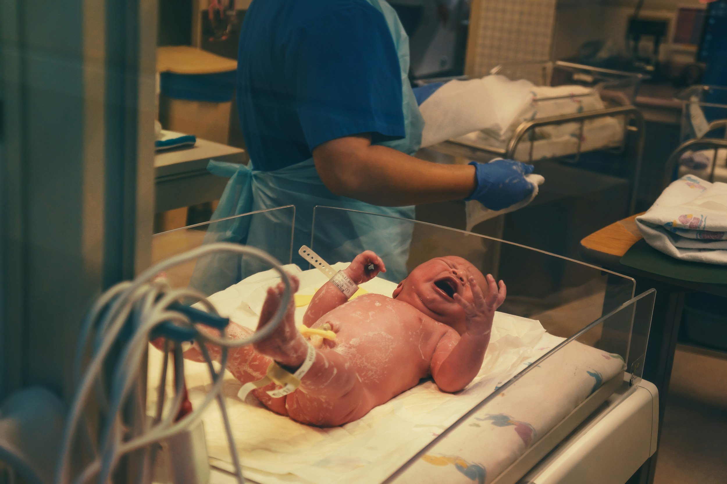 Image of a baby after birth