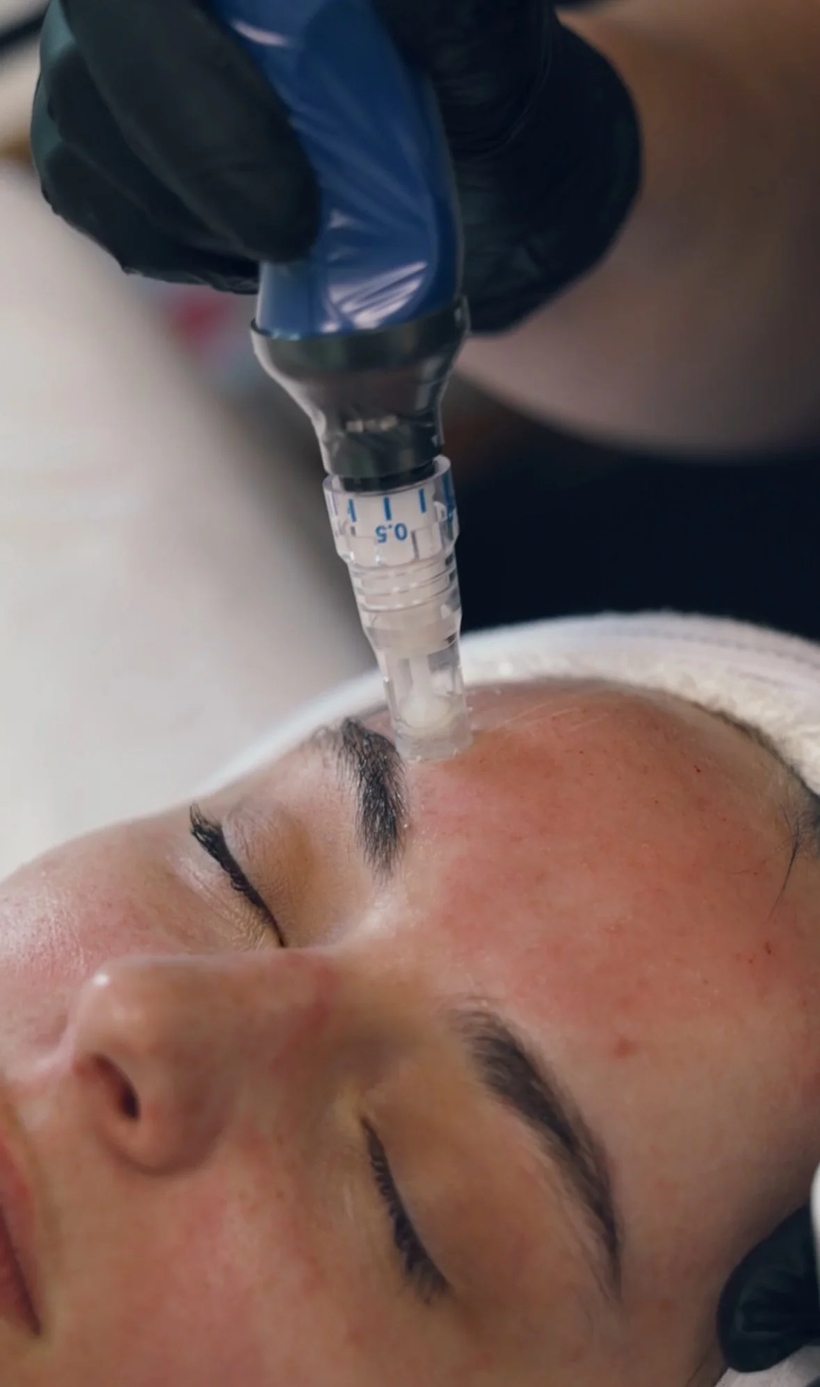 A person receiving a facial treatment with a device pressed gently onto their forehead, lying down with eyes closed.