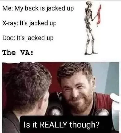 Back pain meme