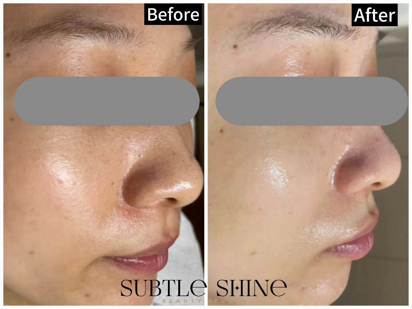 ☀️ How to Get Your Skin Holiday-Ready

Summer&rsquo;s coming &mdash; more sunshine, more heat, and more celebrations.
Here&rsquo;s how to keep your skin calm, hydrated, and glowing through it all 👇

1️⃣ Reset after winter
Gentle exfoliation or deep-