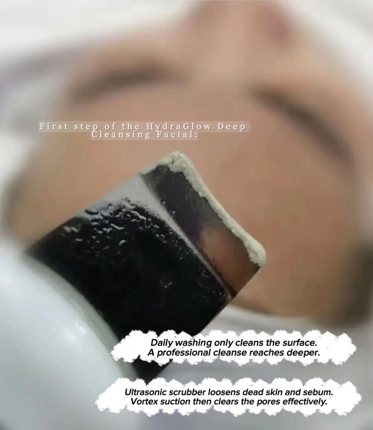 When the skin feels weighed down, it&rsquo;s not always about oil &mdash; it&rsquo;s about what stays on the surface.
A proper reset gives the skin space to breathe and absorb moisture more easily.
It&rsquo;s a small step that makes the skin feel nat