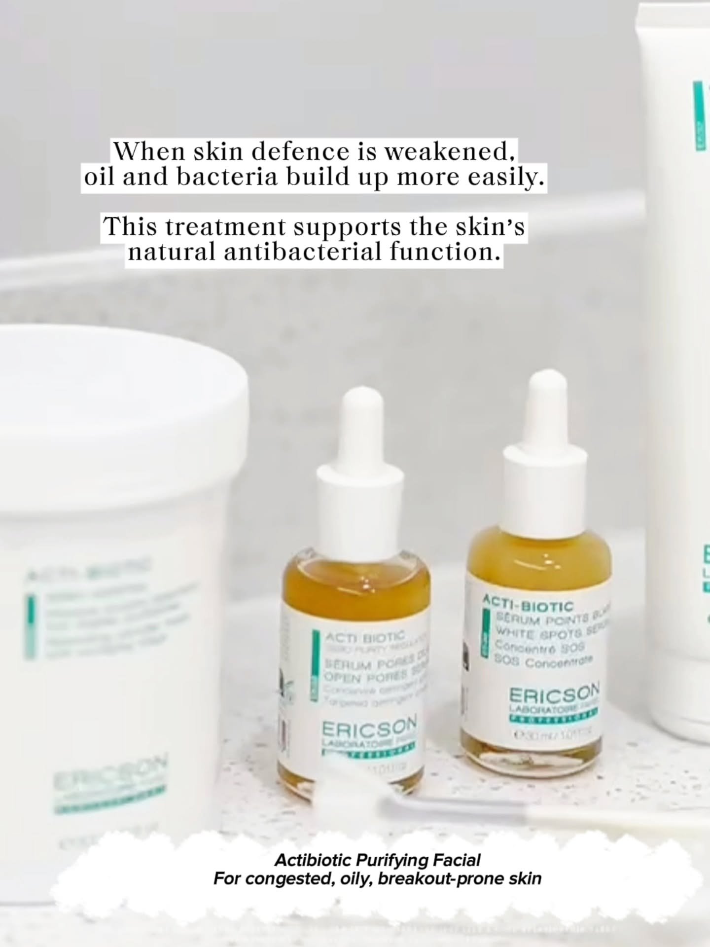 Acne is usually multi-factor. Hormonal fluctuations can be one contributor &mdash; often by increasing oil production &mdash; but breakouts are also influenced by pore buildup (dead skin + oil), bacteria overgrowth, and ongoing inflammation.

That&rs