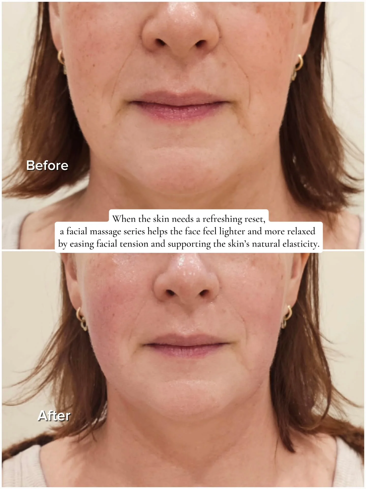 One session doesn&rsquo;t change the skin overnight.
What it can do is begin to shift tension, fluid retention, and how the skin responds.
Often, the first change clients notice is how the face feels &mdash; lighter, less tight, and more at ease.

Ta
