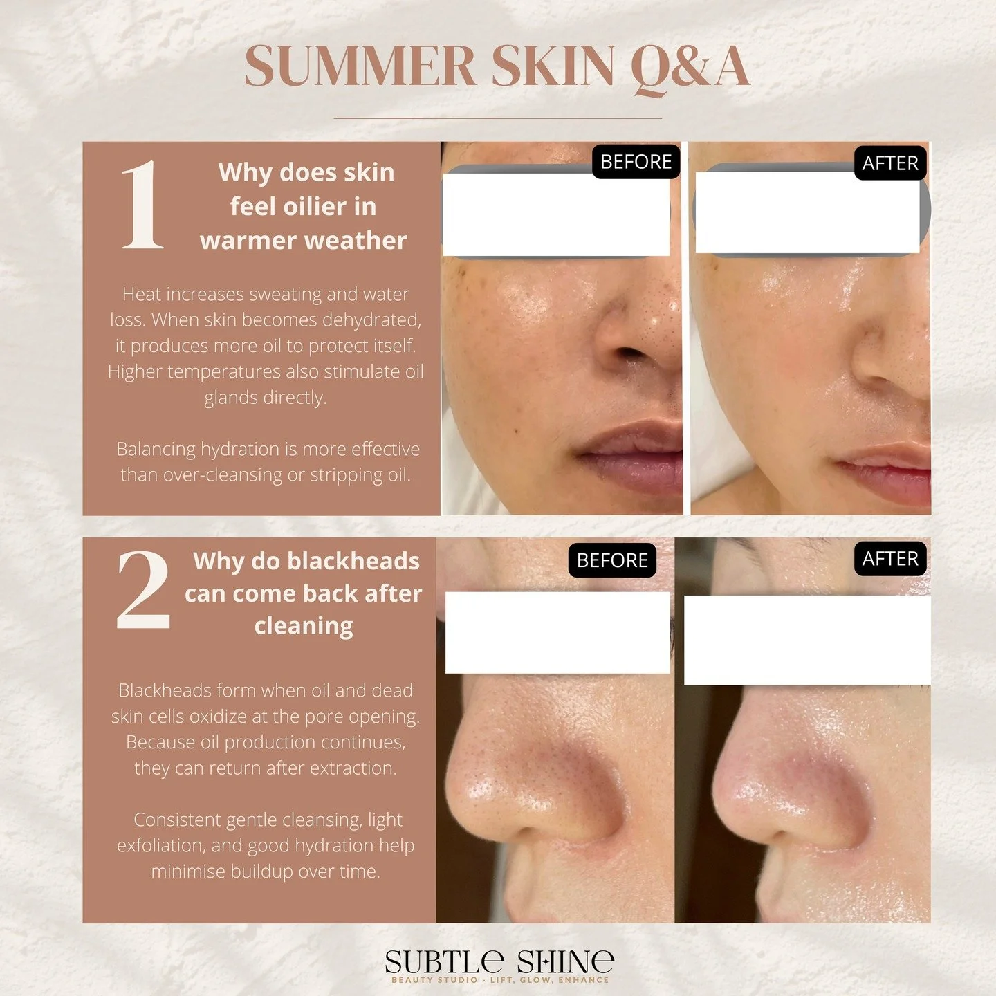 If your skin feels oilier, duller, or more reactive in summer, it&rsquo;s a common seasonal response.

Heat, UV exposure, and higher water loss change how skin functions beneath the surface. What appears later is often a reaction, rather than a sudde