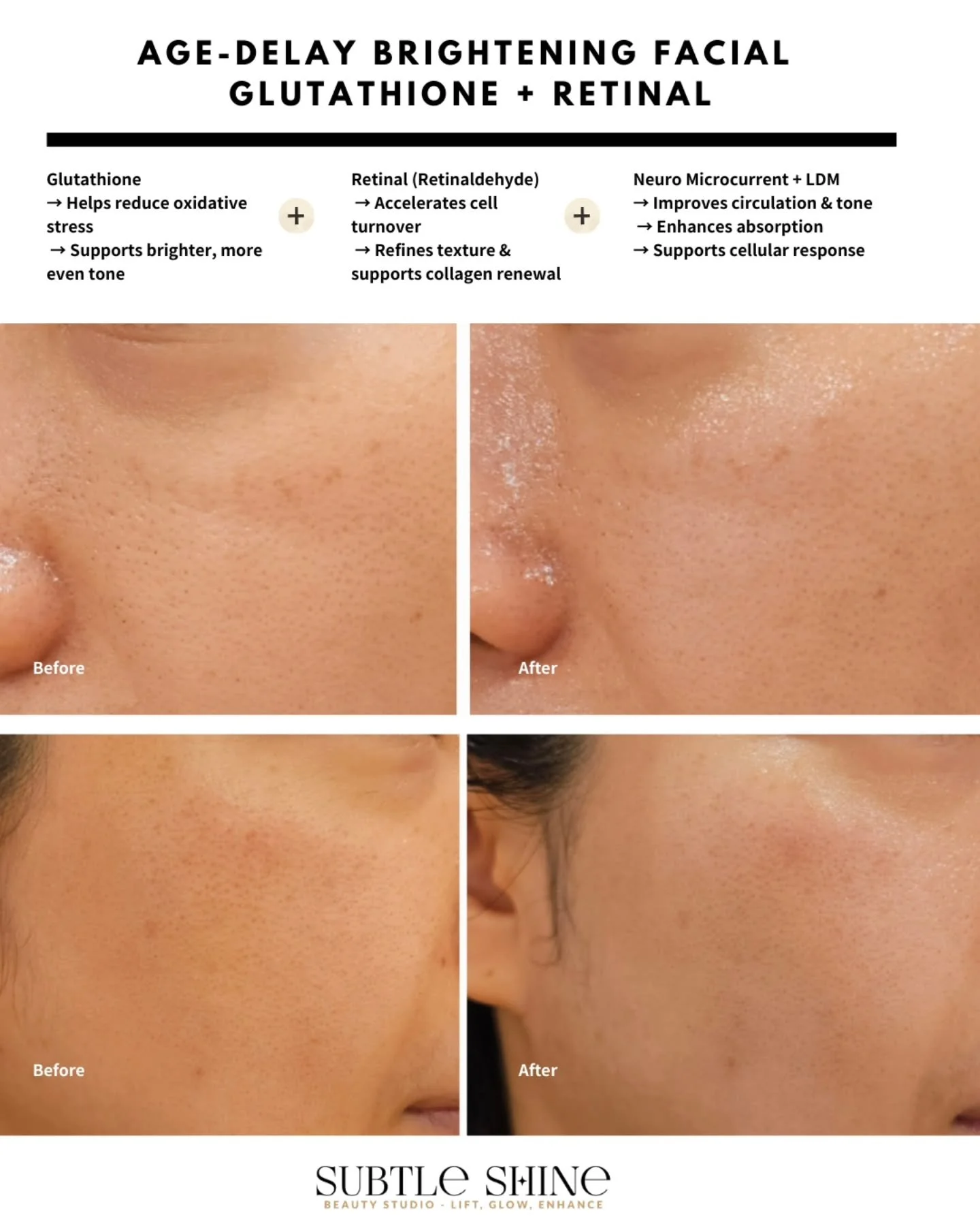 Age-Delay Brightening Facial
Glutathione + Retinal

How it works:
Glutathione helps neutralise oxidative stress, which can contribute to uneven tone over time.

Retinal (Retinaldehyde) supports regulated cell turnover, helping improve texture and cla