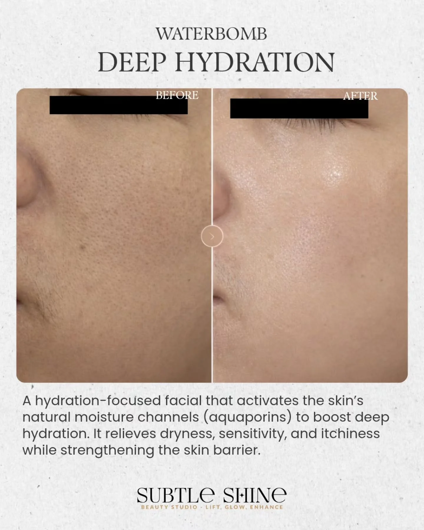 Melbourne's autumn air is already starting to shift 🍂

If your skin has been feeling a little tighter, duller, or just harder to keep hydrated lately &mdash; you're not imagining it. The cooler, drier air can make it harder for the skin barrier to h