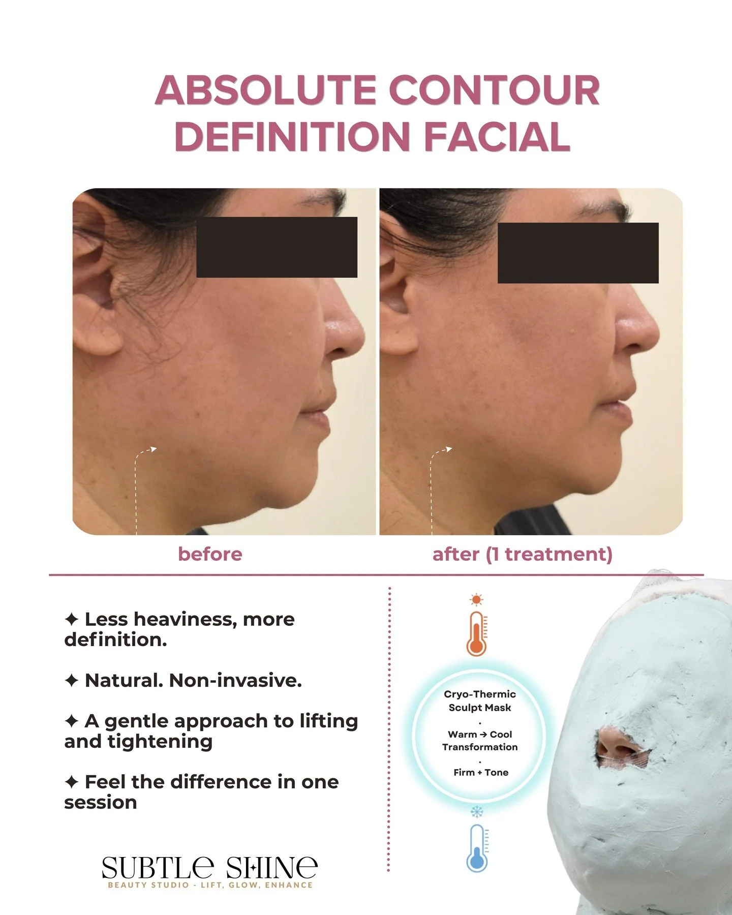 Some results you don't expect to see after just one treatment.

This is the Absolute Contour Definition Facial &mdash; a 120-minute protocol that works on jawline definition, lower-face lifting, and skin firmness. No injectables. No downtime.

What's