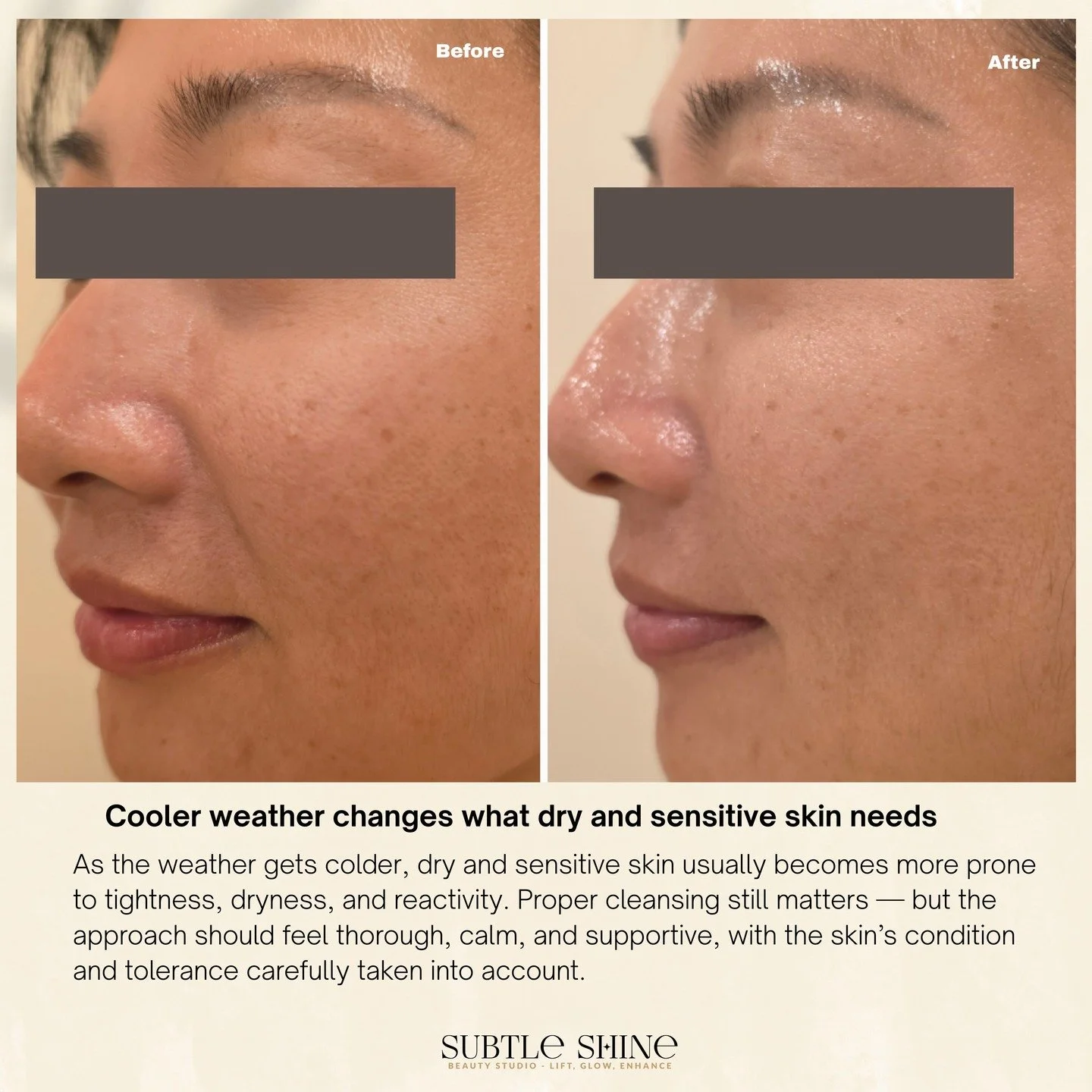 As the weather gets cooler, dry and sensitive skin can need a little more care around deep cleansing. The treatment approach and aftercare can make a real difference, especially when the skin is already feeling a little dry, tight, or delicate.

Tap 