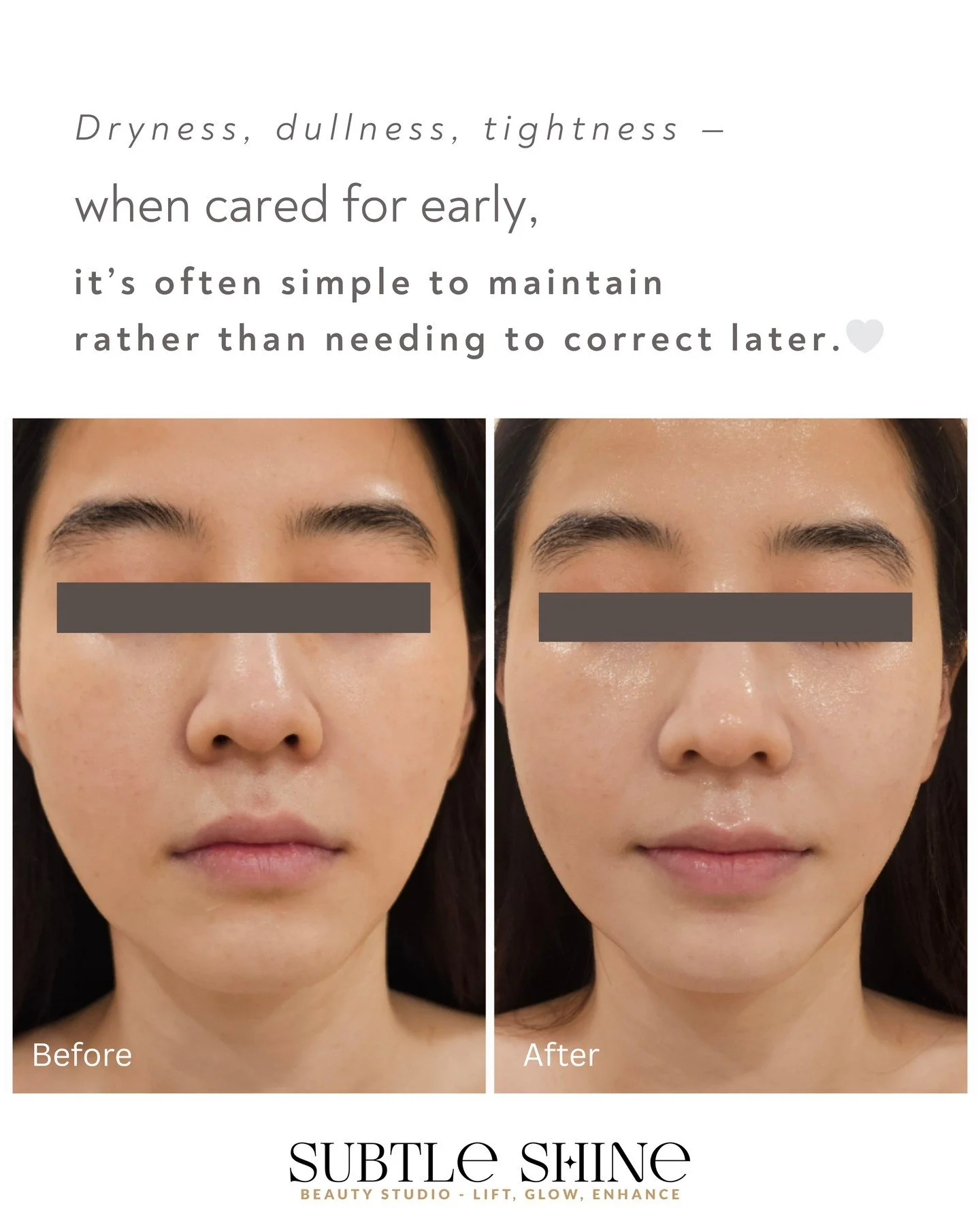 Skin concerns rarely appear all at once &mdash;
they tend to build gradually over time.
Addressing them early
makes it easier to manage
before they become more visible.

#melbournefacial #skinbalance #healthyskinjourney #porecare #glowingskin