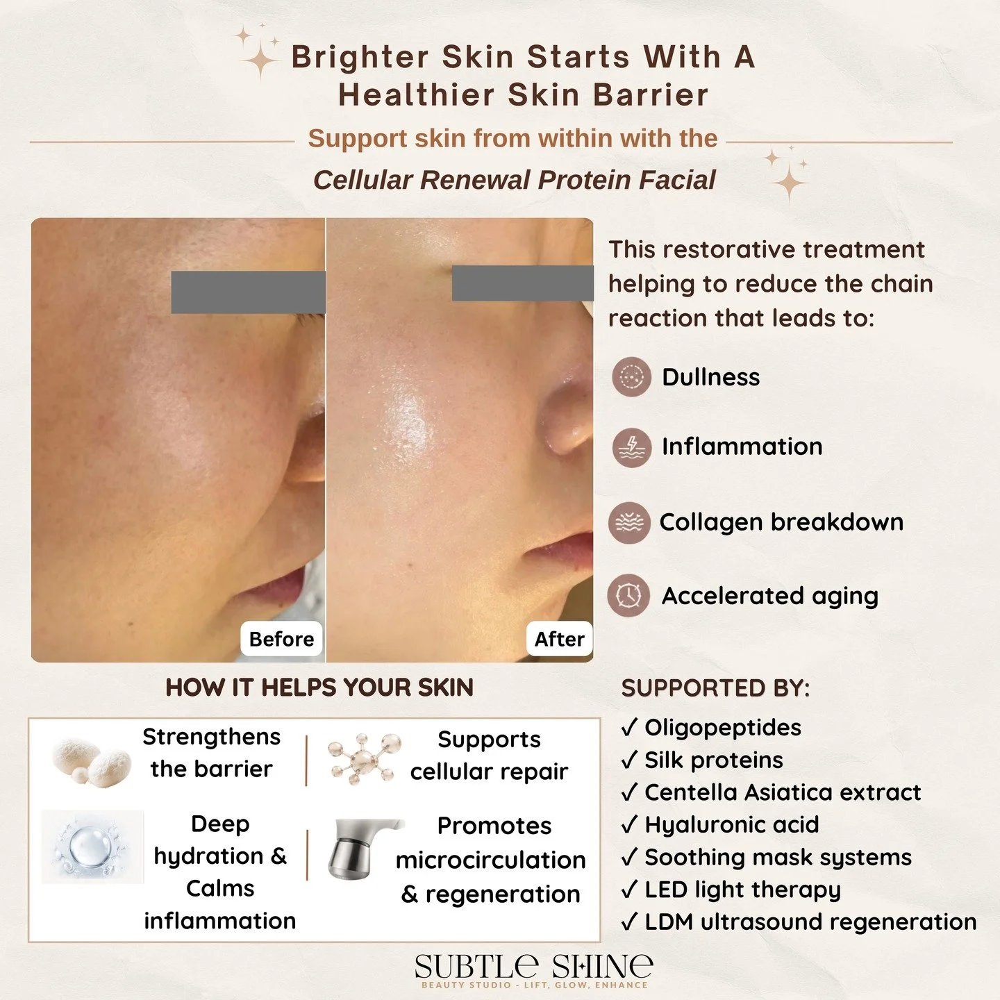 Brighter skin isn&rsquo;t only about &ldquo;whitening.&rdquo;

When the skin barrier becomes weakened or inflamed, oxidative stress can increase more easily inside the skin &mdash; often contributing to dullness, uneven tone, post-inflammatory pigmen