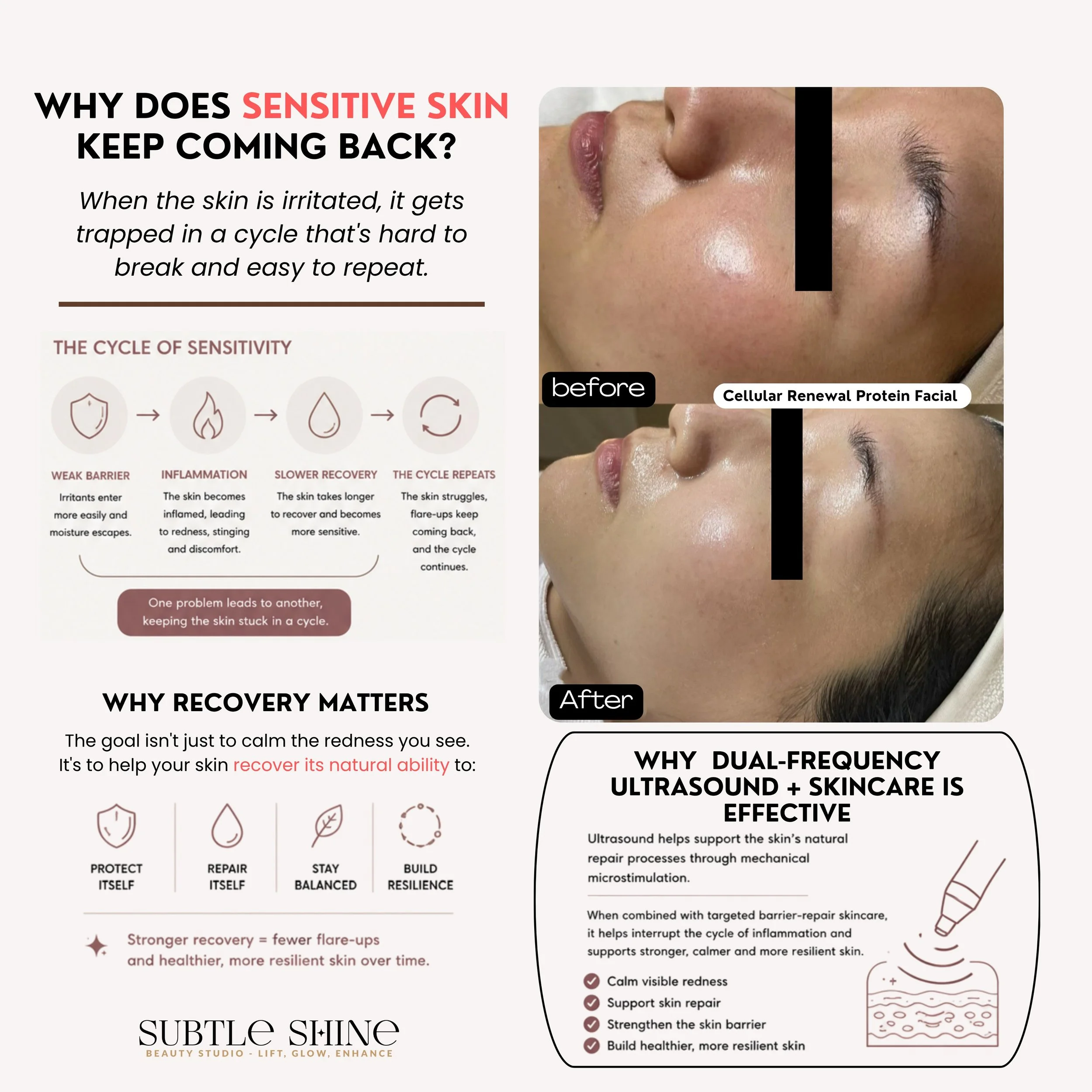 Why does sensitive skin keep coming back? 🤔

Many people think sensitive skin is only about a weakened skin barrier. While the skin barrier plays an important role, healthy skin also needs the ability to repair and recover after irritation. When rec