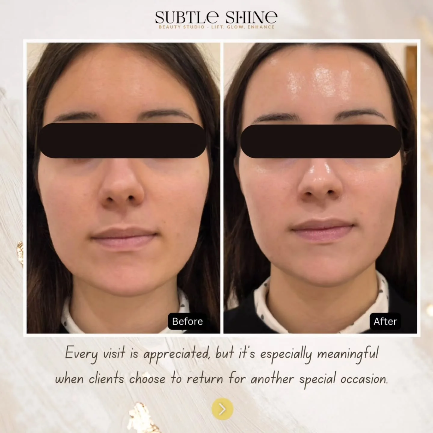 Seeing clients return is always special. Knowing that so many have also recommended Subtle Shine to their family and friends means more than words can say. 🤍 I feel incredibly fortunate to meet so many wonderful people through my work.

#sentiveskin