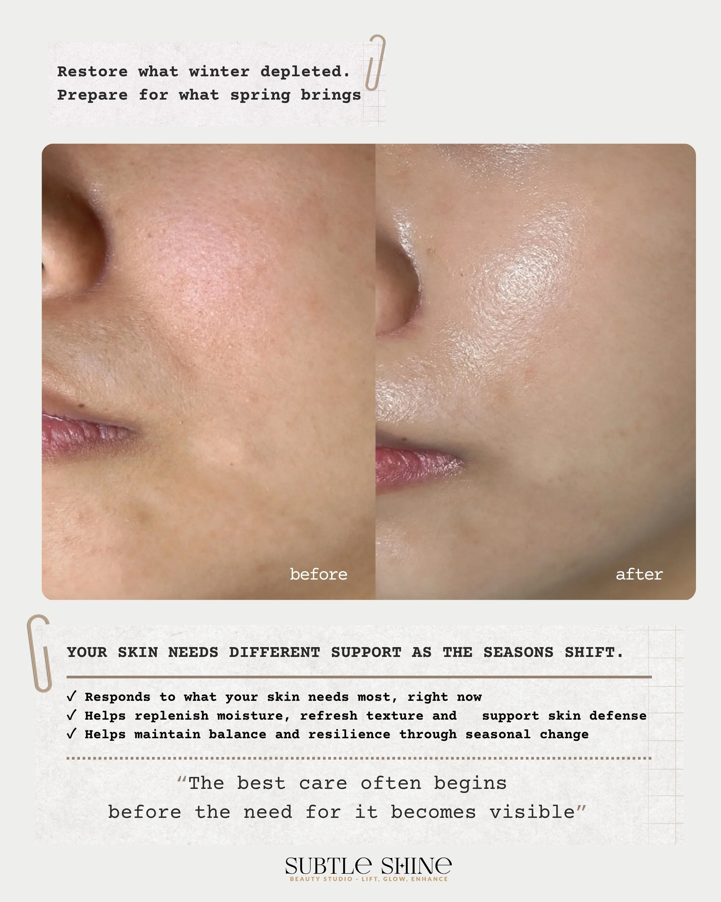 Melbourne winter can really show on the skin.

Dryness, dullness, uneven texture and skin that feels a little more depleted after months of cold weather and indoor heating.

With spring around the corner, it&rsquo;s a good time to replenish moisture,