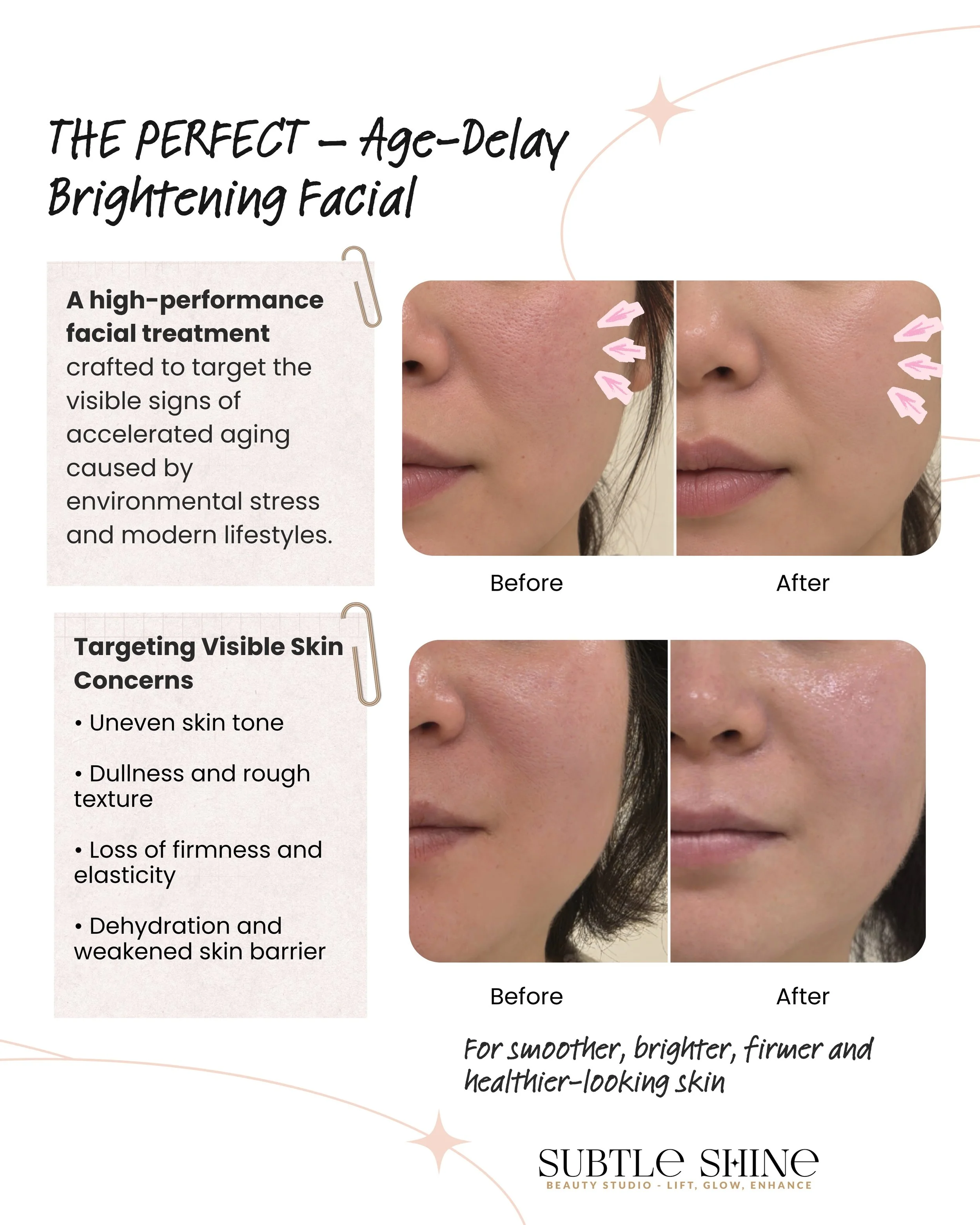 ✨ A SKIN REFRESH FOR THE FESTIVE SEASON

With the festive season approaching, it's a lovely time to give your skin some extra attention before the celebrations begin.

THE PERFECT &ndash; Age-Delay Brightening Facial

This comprehensive facial begins