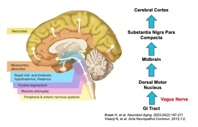 This image shows the direction and pathway in which alpha-synuclein travels up the vagus nerve.