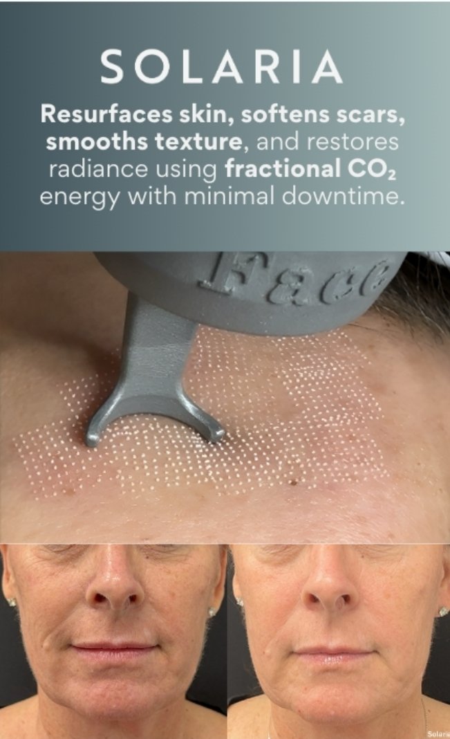 Morpheus8 vs Fractional CO2 Laser: Which Is Better for me?