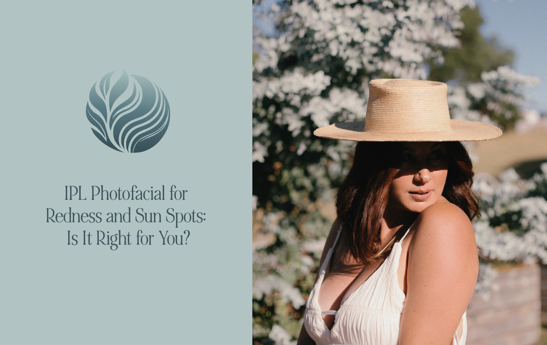 IPL Photofacial for Redness and Sun Spots: Is It Right for You 