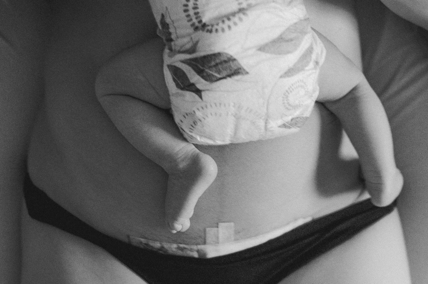 Schwarz‑Weiß Babyfotografie – Detailaufnahme von Babyhänden und Kaiserschnittnarbe auf Mamas Brust