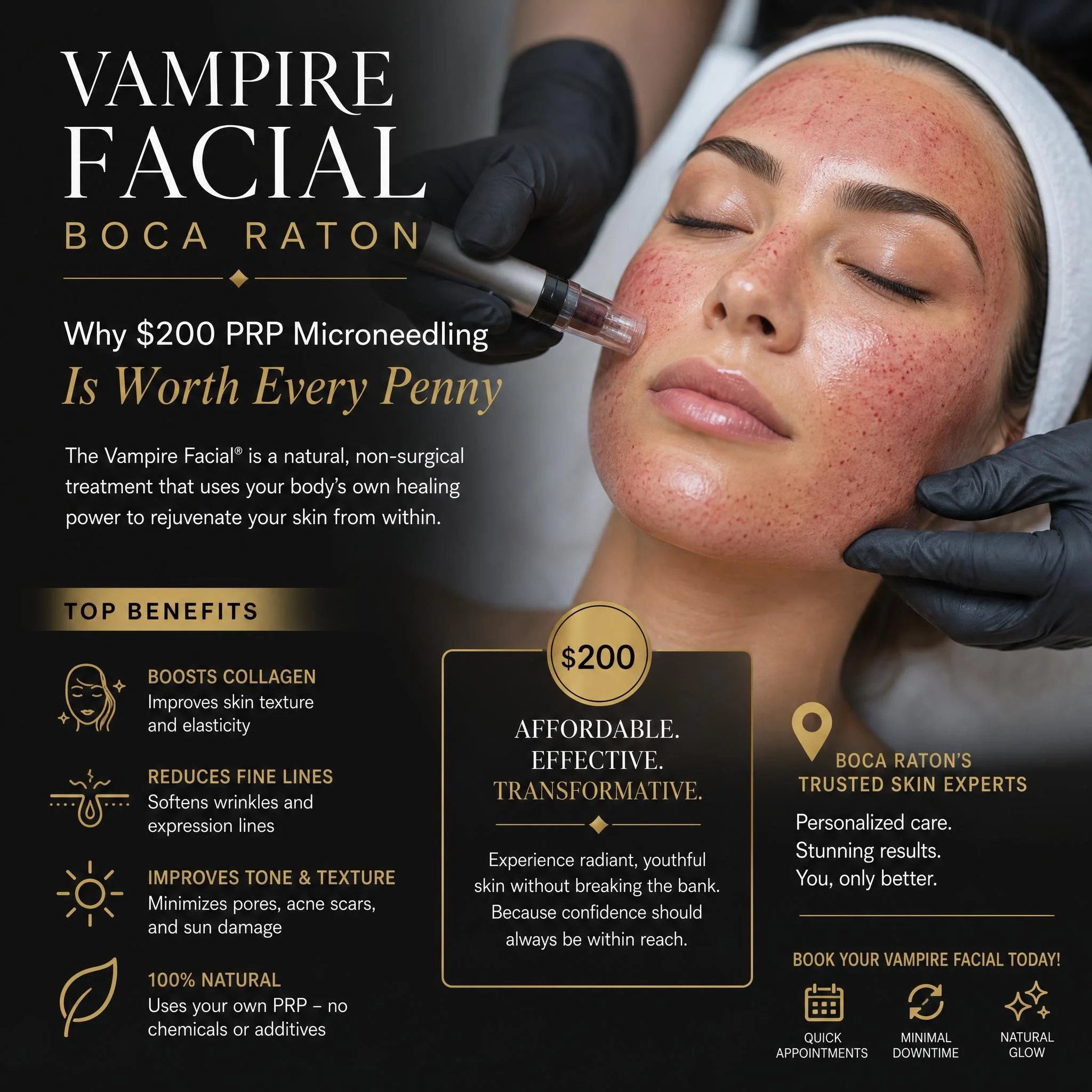 Vampire Facial Boca Raton: Why $200 PRP Microneedling Is Worth Every Penny